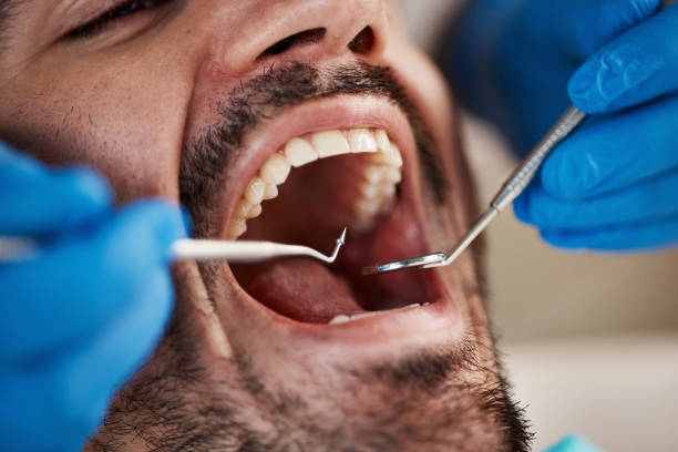 Best Emergency Dental Care for Broken or Chipped Teeth in Bedford, IN